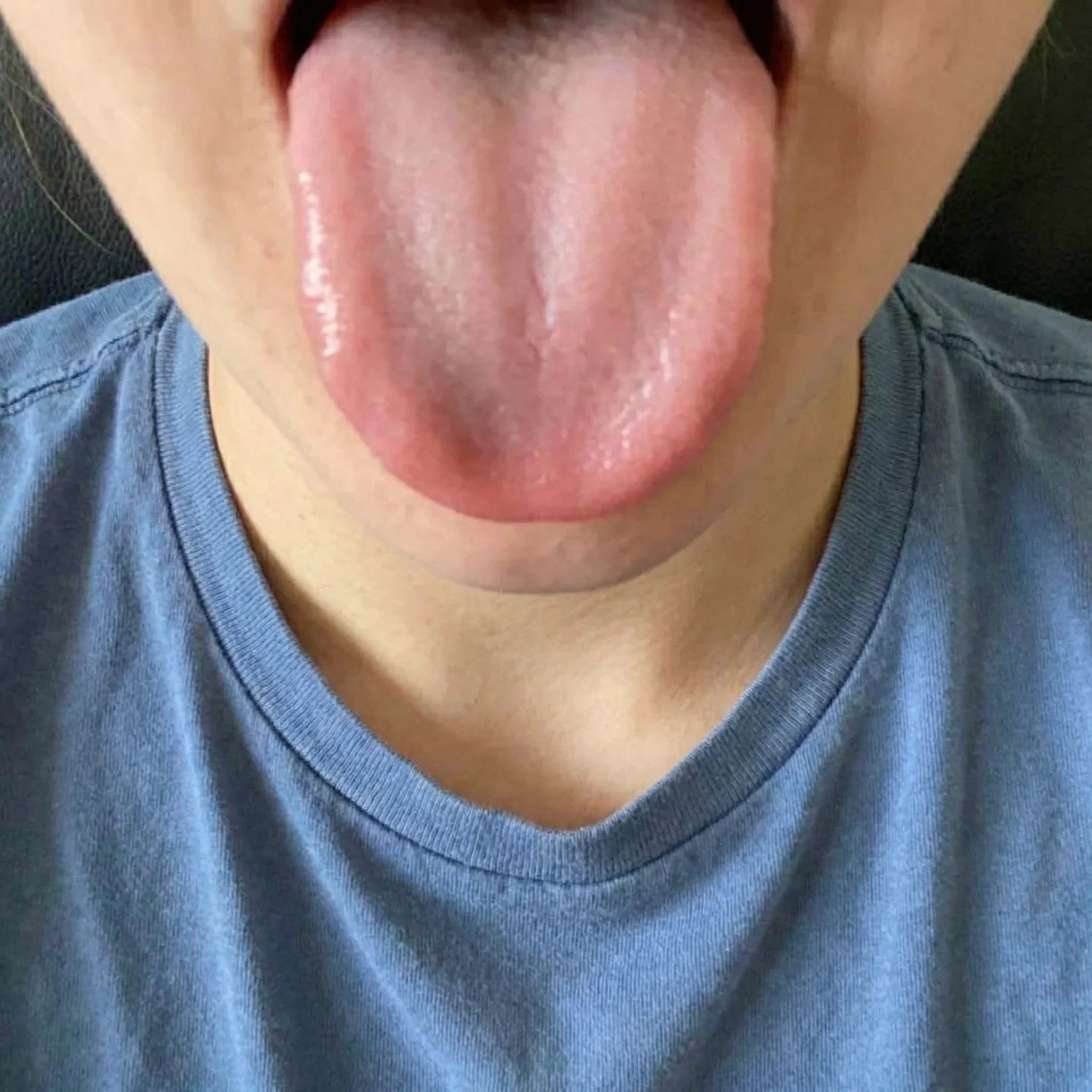 After 30 days